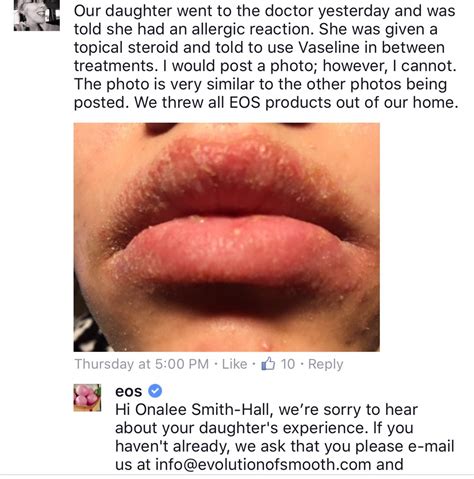 allergic reaction to lip balm